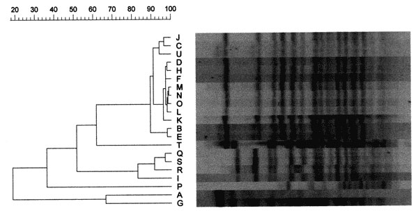 Results of pulsed-field gel electrophoresis (PFGE) of clinical and environmental isolates of Burkholderia pseudomallei from western Australia. Molecular typing was performed by electrophoresis of twice-digested 18h XbaI digests of chromosomal DNA from each isolate with a pulse time and ramp of 5.5 to 52 sec from 20h at 200V. Lanes correspond to the following isolates: A,G initial and recurrent infection separated by &gt;12 months in epidemiologically unrelated case in outbreak community; B,C,D,E