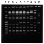 Thumbnail of Pulse-field gel electrophoresis patterns of Avr II-digested DNA of Salmonella Typhimurium strains. Lane 1, S. Newport control strain am01144 (Xba I-digest); lanes 2 through 4, S. Typhimurium strains isolated during the first, second, and third outbreaks in Georgia, respectively; lane 5, strain 00354 (Washington isolate); lane 6, strain 01587 (Washington isolate); lane 7, 9294-99 (Maryland isolate); lanes 8, 9, and 10, genetically unrelated control S. Typhimurium strains isolated in