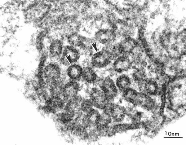 Transmission electron micrograph of a mitochondrion from Rhinosporidium seeberi. The cristae of this mitochondrion (arrows) have tubulovesicular morphology. Magnification 195,000X.