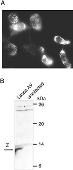 Thumbnail of Detection of Lassa AV in infected Vero cells. (A) Immunofluorescence with NP-specific monoclonal antibody L2F1 40 hours after injection of the serum. (B) Immunoblot analysis with Z protein-specific antiserum.