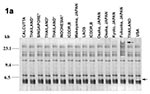 Thumbnail of Southern blot hybridization of BglI-digested Vibrio parahaemolyticus chromosomal DNA with rRNA probe. 1a-1c, ribotype patterns of the O3:K6, O4:K68, and O1:K untypeable (KUT) strains, respectively, isolated from different countries. 1d, ribotype pattern of the nonpandemic strains isolated from different countries and belonging to various serotypes (Table 2). The last three lanes indicate the pattern of the representative O3:K6(KX-V225), O4:K68(KX-V563), and O1:KUT(KX-V737) strains,