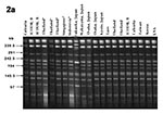 Thumbnail of Electrophoretic migration pattern of the NotI-digested Vibrio parahaemolyticus genomic DNA obtained by pulsed-field gel electrophoresis (PFGE). 2a-2c, PFGE patterns of the O3:K6, O4:K68, and O1:K untypeable (KUT) strains, respectively, isolated from different countries. 2d, PFGE pattern of the nonpandemic strains isolated from different countries and belonging to various serotypes (Table 2). The lanes on the right side of the marker indicate the pattern of the representative O3:K6(K