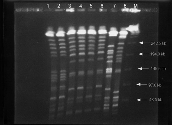 Pulsed-field gel electrophoresis profiles of XbaI-digested genomic DNAs from eight Klebsiella pneumoniae isolates. Lanes 1 and 2, profiles for isolates A1 and A2 (from patient A); lines 3 to 6, profiles for isolates B1 to B4 (from patient B), respectively; and lanes 7 and 8, isolates of K. pneumoniae from two other patients used as control strains. Lane M, bacteriophage lamdba DNA concatemers (GibcoBRL, Gaithersburg, MD)