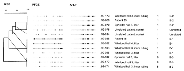 Pulsed-field gel electrophoresis (PFGE) and amplified fragment-length polymorphism (AFLP) patterns of a representative selection of clinical and environmental Legionella pneumophila isolates; the dendrogram shows clustering in PFGE. The AFLP and PFGE pattern of the isolate of patient 15 (genotype B-1) was found in 28 of the 29 isolates of culture-positive cases; the same pattern was found in isolates cultured from the whirlpool spas in halls 3 and 4. The AFLP and PFGE pattern of the isolate of p
