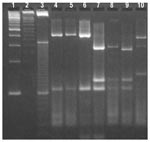 Thumbnail of Restriction profiles obtained after digestion of polymerase chain reaction products from the Cryptosporidium oocyst wall protein locus with Rsa I. Lanes 1- 3-, 100-, 50-, and 10-bp ladder molecular weight markers; lanes 4 and 6, bovine genotype 2 isolates; lanes 7 and 8, human genotype 1 isolates; lane 9, cervine genotype isolate MH205; and lane 10, C. meleagridis isolate CS33