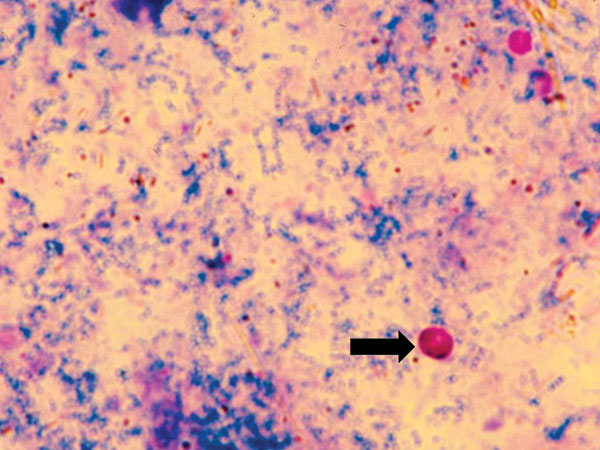 Cryptosporidium muris oocysts (under oil X 1,000), stained by Kinyoun’s acid-fast staining.