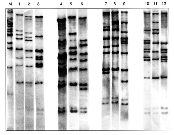 Twelve BstEII ribotypes identified in 47 Corynebacterium diphtheriae isolates collected in the Russian Federation between 1957 and 1987. The figure is composed of ribotype gels exemplifying the different patterns observed in the strain collection. Lane M, molecular weight marker; lane 1, ribotype M11e; lane 2, M11f; lane 3, M13a; lane 4, M7a; lane 5, unique; lane 6, G4; lane 7, unique; lane 8, M11g; lane 9, M3; lane 10, M1b; lane 11, M6; lane 12, M13b.