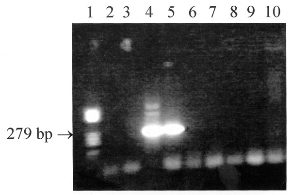Results of the nested polymerase chain reaction (PCR) assay performed on the serum specimens from both patients and their dogs. Lane 1: standard DNA size marker V (Boehringer, Mannheim, Germany); lanes 2 and 3: serum #1 from man; lanes 4 and 5: serum #1 from woman; lanes 6 and 7: serum from dog #1; lanes 8 and 9: serum from dog #2; lane #10: negative control; lanes 2, 4, 6, and 8: pure DNA; and lanes 3, 5, 7, and 9: DNA diluted 1:10 in deionized water.