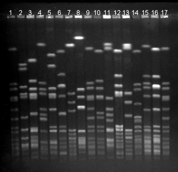 Pulsed-field gel electrophoresis (PFGE) profiles of the 14 most common methicillin-resistant Staphylococcus aureus (MRSA) strain types identified, Finland, 1997–1999. Lanes 1, 9, 17: S. aureus NCTC 8325 (molecular weight marker); lanes 2–4: strain types associated with community acquisition (Mikkeli clone, E22, E31); lane 5: E1; lane 6: E24; lane 7: E5; lane 8: Kemi clone; lane 10: E27; lane 11: UK EMRSA-15; lane 12: E19; lane 13: Pori clone; lane 14: E20; lane 15: Iberian clone; and lane 16: O25.