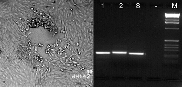 Left: cytopathic effect in Vero cells consisting of a plaque and rounding of the cells after homogenized altered mucosal membrane of the marmoset was added to the cell culture. Right: type-specific polymerase chain reaction (PCR). Lanes 1 and 2 show fragments of 229-bp DNA amplified from Human herpesvirus 1 (HHV-1) and 241 bp from HHV-2 control strains, respectively. Lane S shows an HHV-1–specific PCR product amplified from an oral mucosa specimen of the marmoset; no product was obtained from supernatants of uninfected cell culture (lane -). Lane M, 1 kb DNA Ladder (GIBCO/BRL,Grand Island, NY).