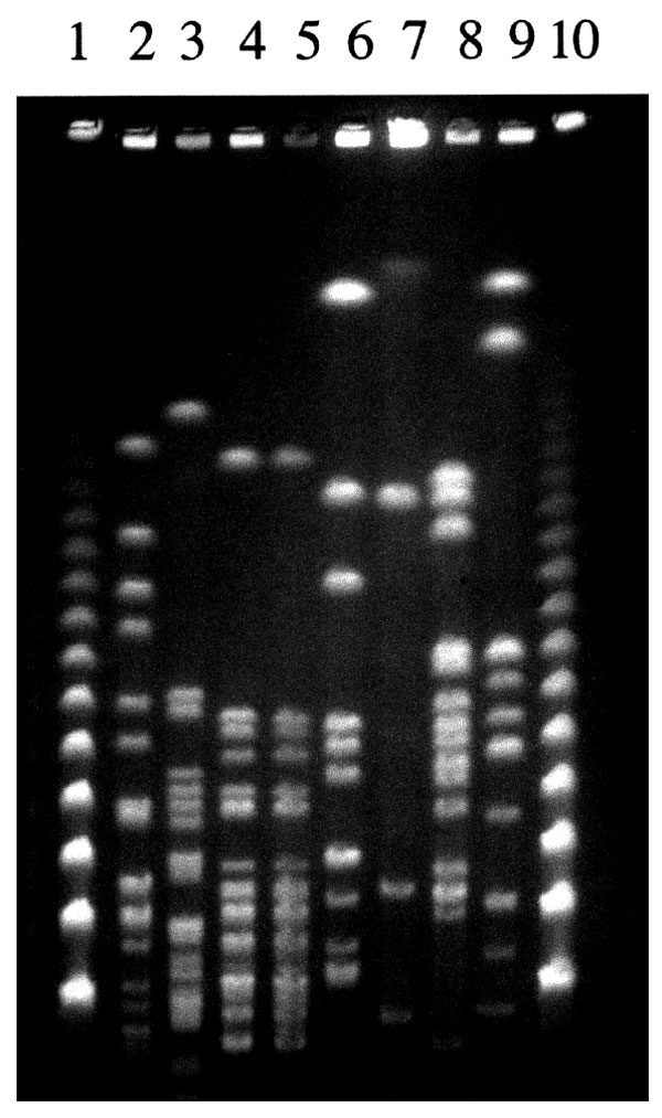 NotI restriction patterns of Leptospira strains obtained with the Bio-Rad apparatus (Richmond, CA) with a pulse time ramped from 5 to 90 s for 36 h. The lanes contain lambda concatemers (lanes 1 and 10) and DNA from isolates: patient strain (lane 2); L. fainei hurstbridge, strain But 6 (lane 3); L. inadai Lyme, strain 10 (lane 4); L. inadai biflexa, strain LT430 (lane 5); L. biflexa patoc, strain Patoc I (lane 6); L. meyeri semaranga, strain VS173 (lane 7); L. kirschneri grippotyphosa, strain MoskvaV (lane 8); and L. interrogans icterohaemorrhagiae, strain Verdun (lane 9).