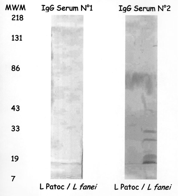Western immunoblot of the patient's acute- (No. 1) and convalescent-phase (No. 2) sera on Leptospira serovar patoc and L. fainei. MWM indicates molecular weight markers.