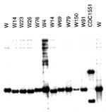 Thumbnail of Southern blot hybridization with the DRab probe. The DRab probe was used to hybridize against the PvuII-digested chromosomal DNA previously used for IS6110 fingerprinting. Members of the W14 group had a single hybridizing band of a slight lower molecular weight than that of other W variants. In contrast, strain CDC1551, which is known to have an insertion within the direct-repeat locus, yielded two hybridizing bands, including one of higher molecular weight. Both hybridizing bands i