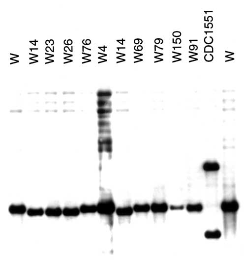 Southern blot hybridization with the DRab probe. The DRab probe was used to hybridize against the PvuII-digested chromosomal DNA previously used for IS6110 fingerprinting. Members of the W14 group had a single hybridizing band of a slight lower molecular weight than that of other W variants. In contrast, strain CDC1551, which is known to have an insertion within the direct-repeat locus, yielded two hybridizing bands, including one of higher molecular weight. Both hybridizing bands in strain CDC1