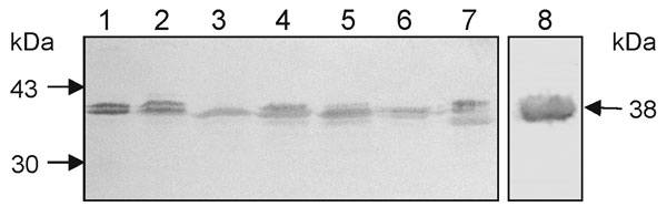 Identification of the 38-kDa flagellin protein SMFliC in clinical isolates of Stenotrophomonas maltophilia. Lane 1, SMDP14; lane 2, SMDP275; lane 3, SMHC176; lane 4, SMHC181; lane 5, SMDP315; lane 6, SMDP314; and lane 7, SMHC179. Lane 8, the purified SMFliC, was used as positive control. The immunoblot shows the presence of the 38-kDa flagellin protein in all the isolates. Doublet bands were seen in some of the isolates. Molecular weight standards and the 38-kDa flagellin protein are indicated by arrows.