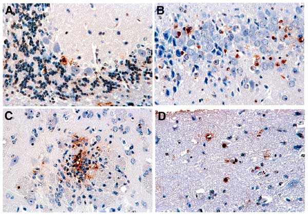 In situ terminal deoxynucleotidyl transferase-mediated dUTP nick-end labeling (TUNEL) staining (ApopTaq peroxidase kit, Intergen Company, Purchase, NY) of neurons undergoing apoptotic cell death (brown-colored nuclear staining). A. Cerebellar cortex, showing occasional positively stained Purkinje cells. B. Hippocampus. C. Positively stained neurons within a microglial nodule. D. Positively stained neurons in cerebral cortex. Magnification 200x.