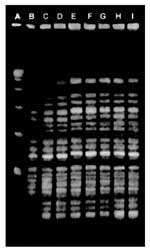 Thumbnail of Pulsed-field gel electrophoresis patterns of SmaI digests of genomic DNA of Lactococcus lactis subsp. lactis clinical isolates. Lane A, molecular weight marker; lanes B, D, F, and H, liver isolates from samples S-15, S-16, S-17, and S-18; lanes C, E, and G, lung isolates of samples S-15, S-16, and S-17; and lane I, spleen isolate from sample S-18.