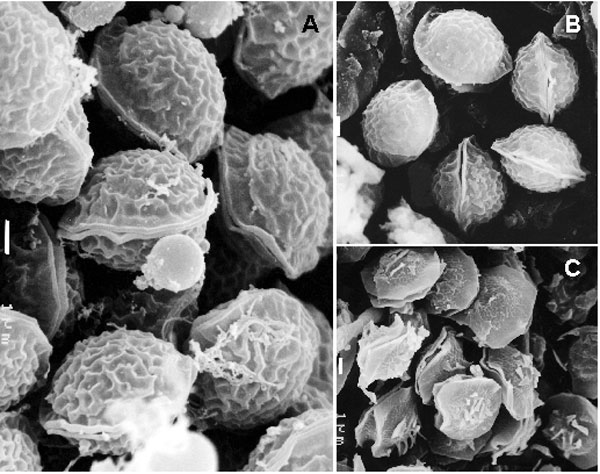 Ascospores of Neosartorya hiratsukae, CBS 109356 (A) and NHL 3008 (B), and of N. pseudofischeri, NRRL 3496 (C), under scanning electron microscopy. Bars A, B, C = 1 µm.