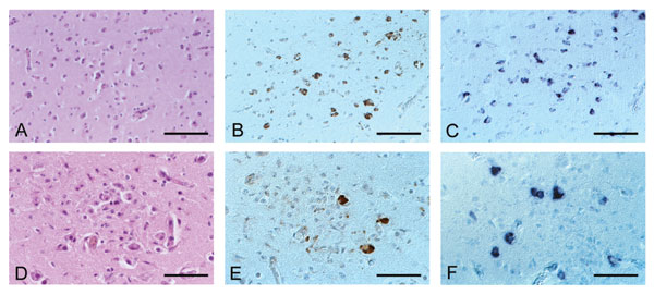 Histology and detection of viral signals in paraffin-embedded tissue sections of birds infected with Usutu virus (USUV). A–C, Eurasian Blackbird; D–F, Great Gray Owl; A, no histologic lesions present, hematoxylin and eosin staining; B immunohistochemistry, using a polyclonal antibody to West Nile virus, shows numerous positive neurons; C, in situ hybridization with USUV-specific oligonucleotide probe shows a staining pattern comparable with that in B; D, microglial nodule within the cerebral cortex, hematoxylin and eosin staining; E, immunohistochemistry shows single positive neurons within a glial nodule; F, in situ hybridization shows several positive neurons next to a glial nodule. Original magnification, x 130 (A–C), x 200 (D–F).