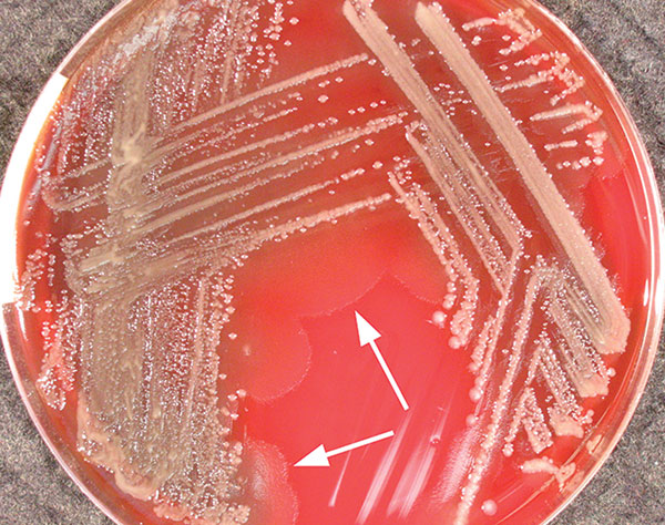 Photorhabdus isolate from patient 2, growing on tryptic soy agar containing 5% sheep blood, after 48 hours’ incubation at 35°C. Arrows indicate “swarming.” The colonies could be seen to glow faintly with the naked eye under conditions of total darkness after 10 minutes of adjustment.
