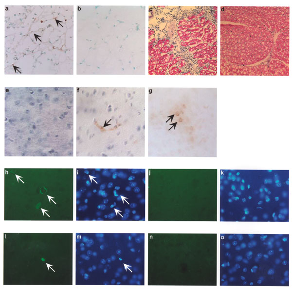 In vivo West Nile virus capsid (Cp) expression induces apoptosis and inflammation in mice. TUNEL assay was performed on muscle cryosections harvested from mice injected with pcWNV-Cp-DJY (a) or pcDNA3.1 (b). Hematoxylin/eosin staining was performed on mouse tibialis muscle cryosections harvested from mice injected with pcWNV-Cp-DJY (c) or pcDNA3.1 (d) at 48 h postinjection (magnification: 200X [a, b] and 40X [c,d]). Immunohistochemical analysis was performed for detection of WNVCp-DJY protein expression in mouse brain injected with pcDNA3.1 or pcWNV-Cp-DJY as detected with horseradish peroxidase (HRP) (e,f, respectively). TUNEL assay on mouse brain cryosections harvested from pcWNV-Cp-DJY injected mouse was detected with HRP (g) (magnification: 300X [e–g]). Immunohistochemical studies were performed for detection of WNV-Cp-DJY protein expression in mouse brain injected with pcWNV-Cp-DJY or pcDNA3.1 as detected by fluorescein isothiocynate stain (h, i, and j, k, respectively). TUNEL assay on mouse brain cryosections harvested from pcWNV-Cp-DJY–injected mice (l,m) or pcDNA3.1-injected mice as detected with fluorescein isothiocyanate (n,o). WNV-Cp-DJY protein expressing His-positive cells or TUNEL-positive cells were visualized under ultraviolete microscope (h or l, respectively). Nuclear staining for WNV-Cp-DJY– or pcNDA3.1-transfected cells was visualized with appropriate filters (i, m or k, o, respectively) (magnification: 630X [h through o]).