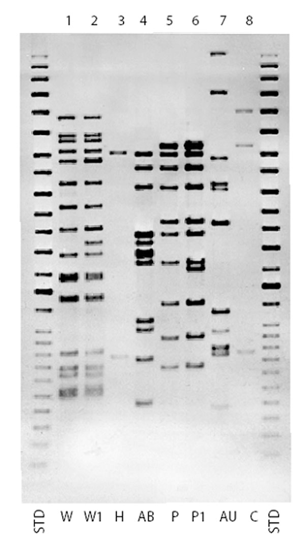 Insertion sequence (IS) 6110 Southern blot hybridization patterns for major multidrug-resistant Mycobacterium tuberculosis strains, New York City, 1995-1997. STD, standard.