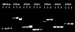 Thumbnail of The variable number of tandem repeats results of three zero-copy IS6110 isolates with identical spoligotyping and polymorphic guanine cytosine-rich repetitive patterns. Seven VNTR loci are listed across the top. Second line represents the patient number of the isolates for each locus.