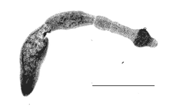 Echinococcus multilocularis isolated from a fox in Hungary. Scale bar: 0.5 mm.