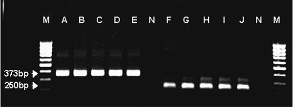 Nested polymerase chain reaction amplification of mitochondrial 12S rRNA gene from five Hungarian Echinococcus multilocularis isolates. Lanes A−E: amplification with outer primers; lanes F−J: amplification with inner primers; N, appropriate negative controls; M, molecular weight marker (100 bp).