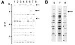 Thumbnail of A) Computer-derived IS6110 restriction fragment length polymorphism patterns from eight laboratories for one isolate. Addition or omission of bands is demonstrated. B) Autoradiogram images demonstrating the addition of IS6110 band in restriction fragment length polymorphism pattern in one subpopulation of Mycobacterium tuberculosis isolates used in the quality assessment exercise.