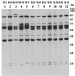 Thumbnail of Southern hybridization analysis of rRNA genes in Vibrio cholerae O139 strains isolated from the recent epidemic and comparison with representative O139 strains isolated between 1992 and 1998. Genomic DNA was digested with BglI and probed with a 7.5-kb BamHI fragment of the Escherichia coli rRNA clone pKK3535. Lanes 1–6 represent O139 strains isolated from 1992 to 1998; lanes 6–12 represent O139 strains isolated from the recent epidemic in Bangladesh. Designated ribotypes corresponding to each restriction pattern are shown on top of the corresponding lane. Numbers indicating molecular sizes of bands correspond to 1-kb DNA ladder (Bethesda Research Laboratories, Bethesda, MD) used as molecular size markers.