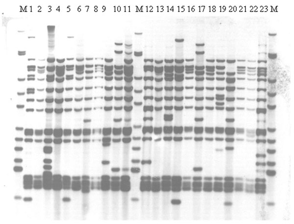 IS6110 restriction fragment length polymorphism analysis of isolates from a dominant variable number tandem repeat group of Beijing family isolates at all sites, Samara, Russia. M indicates Mycobacterium tuberculosis strain MT14323. Isolates were from all five sites including the prison (tracks 13, 16,18, and 20).