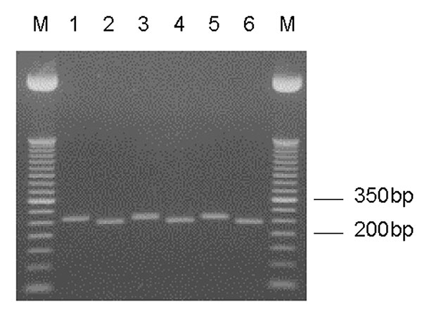 Entamoeba moshkovskii–specific nested SSU rDNA polymerase chain reaction (PCR) products. Odd- and even-numbered lanes represent undigested and XhoI-digested PCR products, respectively. Lanes 1/2, E. moshkovskii Laredo; lanes 3/4–5/6, DNA from stool samples. M, a 50-bp DNA ladder (Invitrogen Corp.).