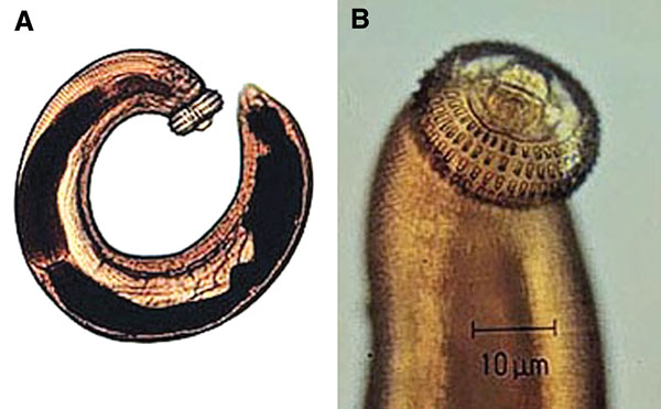 Third-stage larva of Gnathostoma spinigerum. A) whole larva; B) head. (Reproduced with the permission of Pichart Uparanukraw, Department of Parasitology, Faculty of Medicine, Chiang Mai University, Thailand.)
