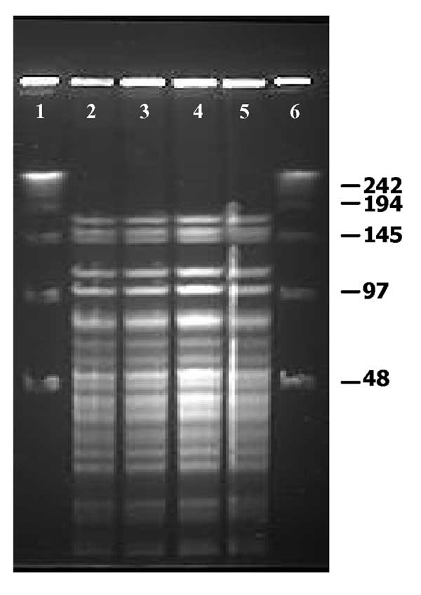 Pulsed-field gel electrophoresis profiles of ApaI-digested genomic DNA of Weissella confusa clinical isolates. Lanes 1–4: Isolates from intestine, brain, spleen, and liver, respectively.