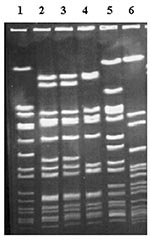 Thumbnail of Pulsed-field gel electrophoresis of selected isolates, demonstrating predominant and secondary types. Lane 1, Staphylococcus aureus NCTC 8325, used as DNA molecular weight reference marker; lanes 2 and 3, clinical isolates of type A13; lane 4, clinical isolate of type A1; lane 5, clinical isolate of type B2; lane 6, clinical isolate of type H.