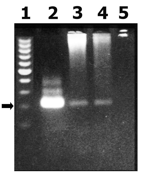 Gel electrophoresis analysis of a polymerase chain reaction (PCR) product corresponding to a highly repetitive 220-bp Trypanosoma cruzi nuclear fragment. 1: molecular weight standards, 2: T . cruzi nuclear 220-bp PCR product, 3 and 4: PCR product from patients blood, 5: PCR negative control (arrows correspond to 220 bp).