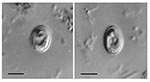 Thumbnail of Nomarski interference contrast photomicrographs of Cryptosporidium muris from the feces of an HIV-positive human. Scale bars = 5 μm.