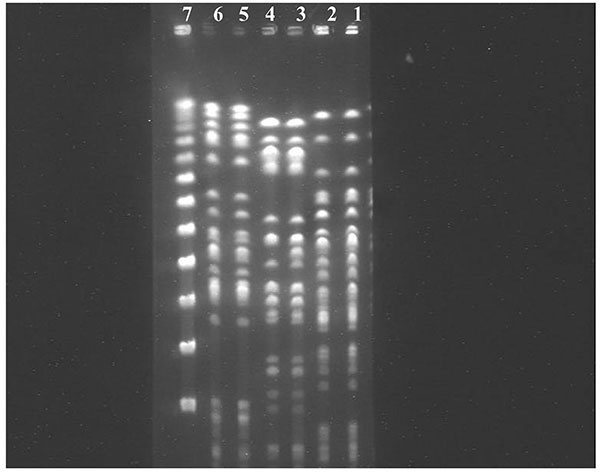 Pulsed-field gel electrophoresis of three pairs of Pseudomonas aeruginosa isolates obtained from three patients from nasogastric tubes (lanes 2, 4, 6) and from oropharynx (lanes 3, 5, 7). Lane 1 shows the λ marker size (New England Biolabs, Eldan, Rosh Ha’ain, Israel).