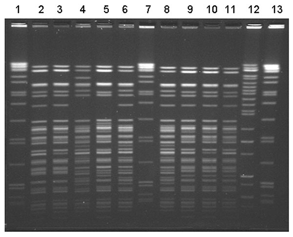 Pulsed-field gel electrophoresis (PFGE) patterns of Yersinia enterocolitica isolates from patients in this outbreak associated with chitterlings. Ten isolates from nine patients were available for typing. Seven distinct BlnI PFGE patterns were noted. Three infants had pattern #1 (lanes 9–11). Two infants shared pattern #2 (lanes 2 and 3). One patient had two distinct isolates (lanes 6 and 12). The molecular size standard is located in lanes 1, 7, and 13.