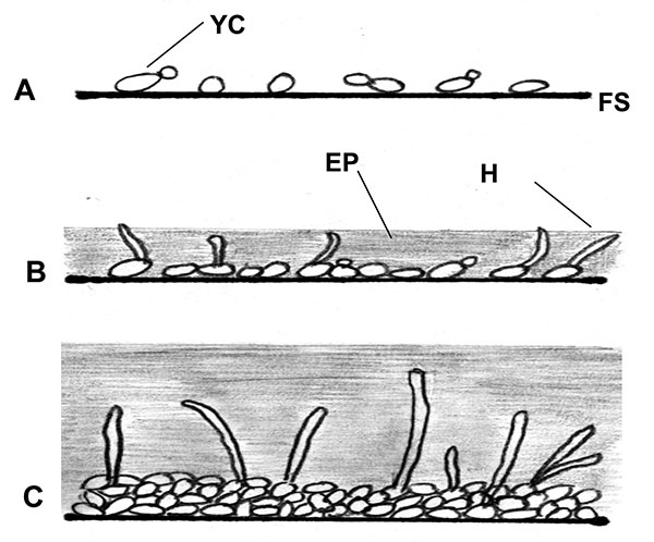 Illustration of biofilm development in Candida albicans and C. dubliniensis; A, early 0–11 h; B, intermediate 12–30 h; C, mature 38–72 h; FS, flat surface; YC, yeast cell; H, hyphae; EP, exopolymeric matrix.