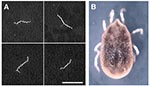 Thumbnail of (A) Borrelia hermsii in the blood of one patient (case 3) stained with rabbit hyper-immune serum and anti-rabbit fluorescein isothiocyanate. Scale bar = 20 μm. (B) An Ornithodoros hermsi nymph collected from the attic of the cabin. The length of the tick is 3.0 mm, excluding the legs.