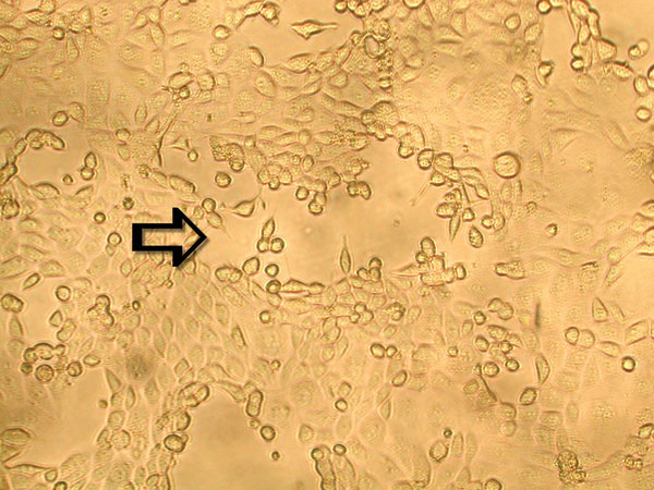 Late cytopathic effect of human metapneumovirus in rhesus monkey kidney (LLC-MK2) cell monolayers. Infected cells progressed slowly from focal rounding to detachment from cell monolayer is indicated by an arrow (100X).