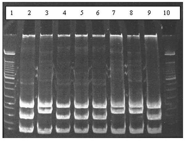 Results of restriction enzyme analysis on 7% polyacrylamide gel showing the two restriction patterns obtained by digesting polymerase chain reaction products with HaeIII. Lanes 2, 4, 5, 6, and 9 show digestion of amplicons of Bartonella taylorii; lanes 3, 7, and 8 show digestion of B. grahamii amplicons; lanes 1 and 10 contain molecular weight markers.