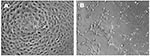 Thumbnail of Microscopic appearance of control (a) and infected (b) Vero E6 cells demonstrating cytopathic effects.