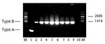 Thumbnail of Molecular subtyping of representative Francisella tularensis isolates from Groups A, B, C, E, and F prairie dogs. The expected size PCR fragments for F. tularensis subsp. tularensis (Type A) and holarctica (Type B) are shown in lanes 1 and 2, respectively. Subtyping results for the five groups (A, B, C, E, F) are shown in lanes 3–9. Lane 3: TX021935 (A); lane 4: TX022151 (A); lane 5: TX022537 (B); lane 6: TX022592 (B); lane 7: TX022799 (C); lane 8: TX022107 (E); lane 9: CZ024233 (F)