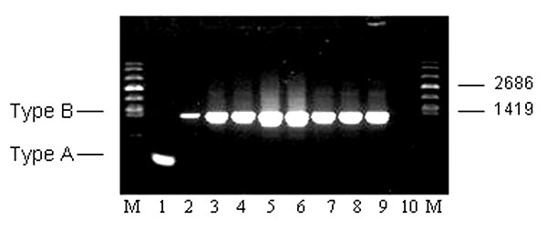 Molecular subtyping of representative Francisella tularensis isolates from Groups A, B, C, E, and F prairie dogs. The expected size PCR fragments for F. tularensis subsp. tularensis (Type A) and holarctica (Type B) are shown in lanes 1 and 2, respectively. Subtyping results for the five groups (A, B, C, E, F) are shown in lanes 3–9. Lane 3: TX021935 (A); lane 4: TX022151 (A); lane 5: TX022537 (B); lane 6: TX022592 (B); lane 7: TX022799 (C); lane 8: TX022107 (E); lane 9: CZ024233 (F). Lane 10: no