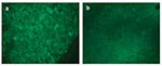 Thumbnail of Direct fluorescent assay (DFA) results on spleen tissues from a seronegative (panel a) and seropositive (panel b) prairie dog.