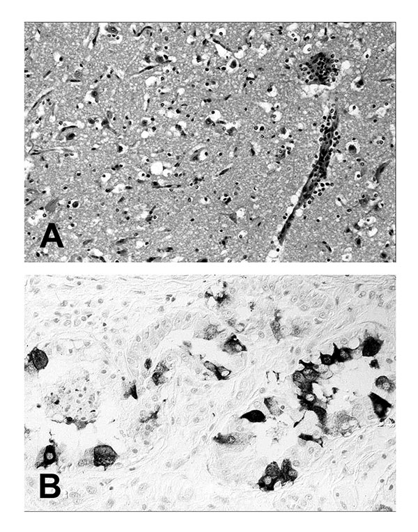 Tissue lesions from a harbor seal (Phoca vitulina) with phocine distemper virus infection. (A) Cerebral cortex with nonsuppurative encephalitis. Hematoxylin and eosin staining. (B) Immunohistochemical labeling of morbilliviral antigen in glandular epithelial cells of the lung. Avidin-biotin-peroxidase technique with Papanicolaou’s hematoxylin counterstain.