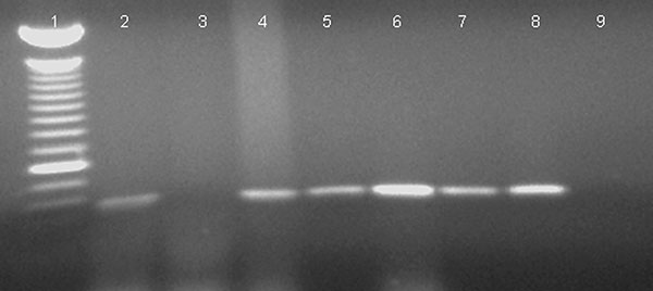 Amplification of severe acute respiratory syndrome–associated coronavirus (SARS-CoV) RNA in chicken blood, using one-step and two-step reverse transcriptase–polymerase chain reaction (RT-PCR) with nucleocapsid primers. Lane 1: 100-bp ladder, the bright band representing 600 bp; Lane 2: chicken 115, 2 days postinocuation (dpi), one-step RT-PCR; lane 3: chicken 115, 2 dpi, two-step RT-PCR (detecting negative-strand RNA); lane 4: chicken 117, 3 dpi, one-step RT-PCR; lane 5: chicken 117, 3 dpi, two-